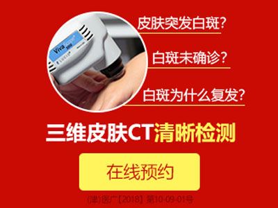 西宁治疗白斑的医院在哪儿？孩子脚上出现白癜风该怎么办？